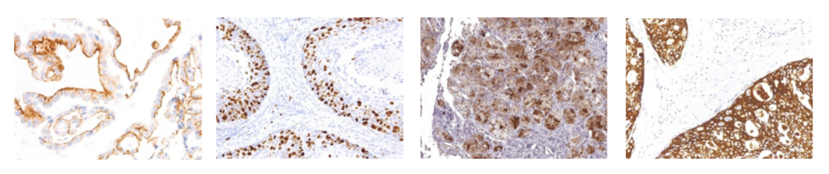 new-Pathology-Antibodies-for-Researchers